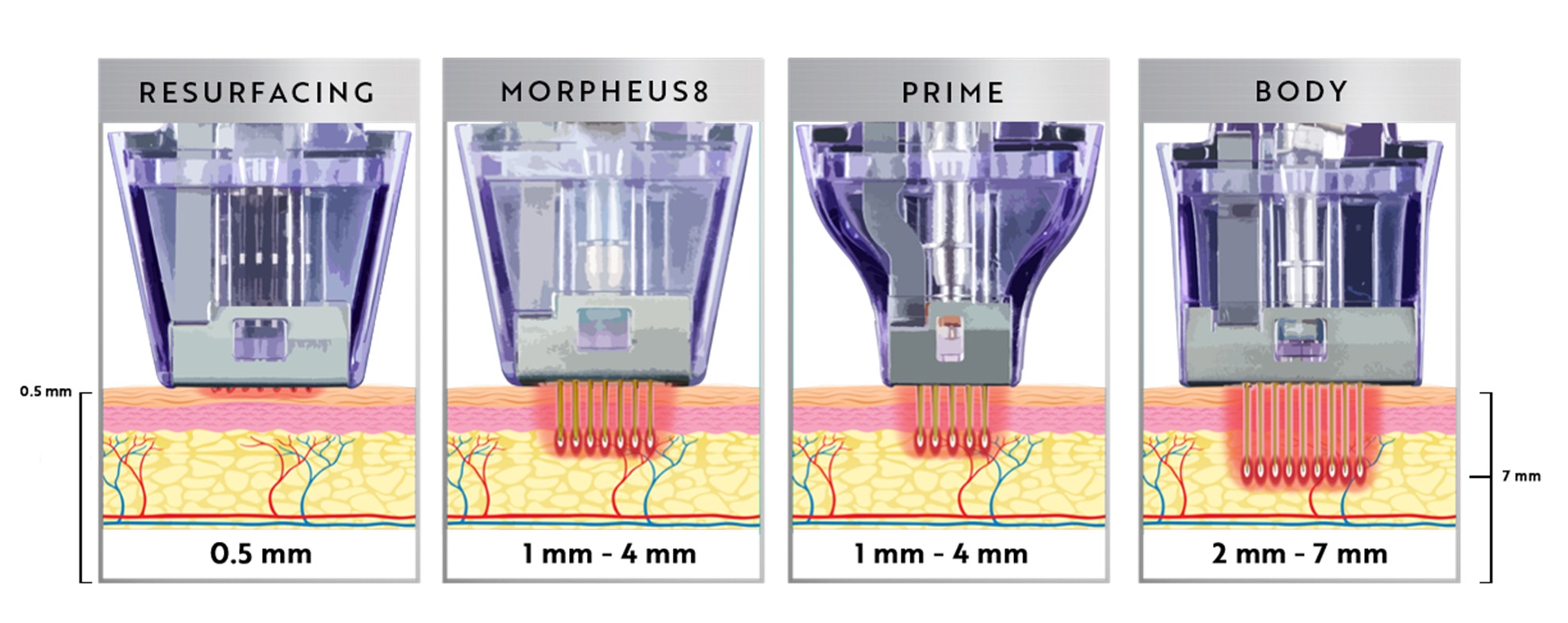 Morpheus8V RF penetration depth diagram showing 0.5mm to 7mm levels